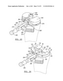 Method And Apparatus For Implanting A Knee Prosthesis diagram and image