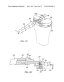 Method And Apparatus For Implanting A Knee Prosthesis diagram and image