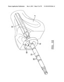 Method And Apparatus For Implanting A Knee Prosthesis diagram and image