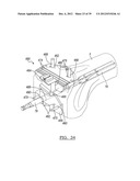 Method And Apparatus For Implanting A Knee Prosthesis diagram and image