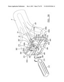 Method And Apparatus For Implanting A Knee Prosthesis diagram and image