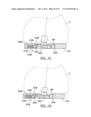 Method And Apparatus For Implanting A Knee Prosthesis diagram and image