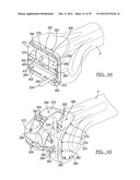 Method And Apparatus For Implanting A Knee Prosthesis diagram and image