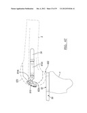 Method And Apparatus For Implanting A Knee Prosthesis diagram and image