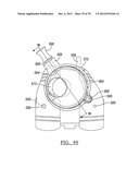 Method And Apparatus For Implanting A Knee Prosthesis diagram and image