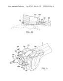 Method And Apparatus For Implanting A Knee Prosthesis diagram and image