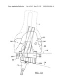 Method And Apparatus For Implanting A Knee Prosthesis diagram and image