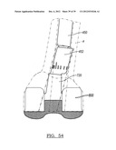 Method And Apparatus For Implanting A Knee Prosthesis diagram and image