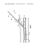 SINGLE PIECE, DUAL COMPONENT SEALING PAD AND METHODS diagram and image