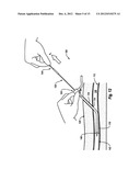 SINGLE PIECE, DUAL COMPONENT SEALING PAD AND METHODS diagram and image