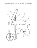 Device and Method for Nasal Surgery diagram and image