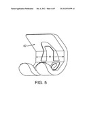 PRE-OPERATIVE PLANNING AND MANUFACTURING METHOD FOR ORTHOPEDIC PROCEDURE diagram and image