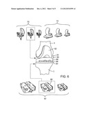 PRE-OPERATIVE PLANNING AND MANUFACTURING METHOD FOR ORTHOPEDIC PROCEDURE diagram and image