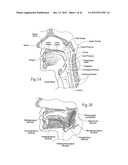 IMPLANTABLE DEVICES, SYSTEMS, AND METHODS FOR MAINTAINING DESIRED     ORIENTATIONS IN TARGETED TISSUE REGIONS diagram and image