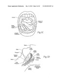 IMPLANTABLE DEVICES, SYSTEMS, AND METHODS FOR MAINTAINING DESIRED     ORIENTATIONS IN TARGETED TISSUE REGIONS diagram and image