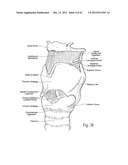 IMPLANTABLE DEVICES, SYSTEMS, AND METHODS FOR MAINTAINING DESIRED     ORIENTATIONS IN TARGETED TISSUE REGIONS diagram and image