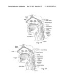 IMPLANTABLE DEVICES, SYSTEMS, AND METHODS FOR MAINTAINING DESIRED     ORIENTATIONS IN TARGETED TISSUE REGIONS diagram and image