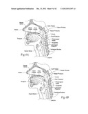 IMPLANTABLE DEVICES, SYSTEMS, AND METHODS FOR MAINTAINING DESIRED     ORIENTATIONS IN TARGETED TISSUE REGIONS diagram and image