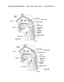 IMPLANTABLE DEVICES, SYSTEMS, AND METHODS FOR MAINTAINING DESIRED     ORIENTATIONS IN TARGETED TISSUE REGIONS diagram and image