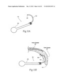 IMPLANTABLE DEVICES, SYSTEMS, AND METHODS FOR MAINTAINING DESIRED     ORIENTATIONS IN TARGETED TISSUE REGIONS diagram and image