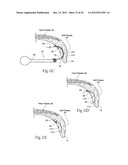 IMPLANTABLE DEVICES, SYSTEMS, AND METHODS FOR MAINTAINING DESIRED     ORIENTATIONS IN TARGETED TISSUE REGIONS diagram and image