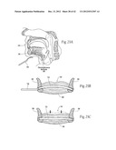 IMPLANTABLE DEVICES, SYSTEMS, AND METHODS FOR MAINTAINING DESIRED     ORIENTATIONS IN TARGETED TISSUE REGIONS diagram and image