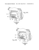 IMPLANTABLE DEVICES, SYSTEMS, AND METHODS FOR MAINTAINING DESIRED     ORIENTATIONS IN TARGETED TISSUE REGIONS diagram and image