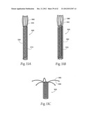 IMPLANTABLE DEVICES, SYSTEMS, AND METHODS FOR MAINTAINING DESIRED     ORIENTATIONS IN TARGETED TISSUE REGIONS diagram and image