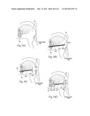 IMPLANTABLE DEVICES, SYSTEMS, AND METHODS FOR MAINTAINING DESIRED     ORIENTATIONS IN TARGETED TISSUE REGIONS diagram and image