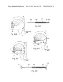 IMPLANTABLE DEVICES, SYSTEMS, AND METHODS FOR MAINTAINING DESIRED     ORIENTATIONS IN TARGETED TISSUE REGIONS diagram and image