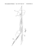 Method and Apparatus for Making Absorbent Structures with Absorbent     Material diagram and image