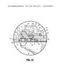 SURGICAL FASTENER APPLYING APPARATUS diagram and image