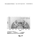 Gantry for Medical Particle Therapy Facility diagram and image