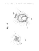 RESONATOR OPTIMIZATIONS FOR WIRELESS ENERGY TRANSFER diagram and image