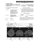 SYSTEM AND METHOD FOR LEADWIRE LOCATION diagram and image