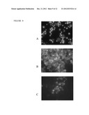 Compositions and Methods for Treating and Diagnosing Cancer diagram and image