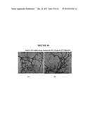 METHODS OF USING REGENERATIVE CELLS IN THE TREATMENT OF PERIPHERAL     VASCULAR DISEASE AND RELATED DISORDERS diagram and image