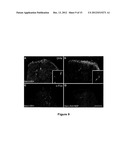 METHODS FOR TREATING BONE CANCER BY ADMINISTERING A NERVE GROWTH FACTOR     ANTAGONIST ANTIBODY diagram and image