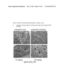 NEUTRALIZING PROLACTIN RECEPTOR ANTIBODIES AND THEIR THERAPEUTIC USE diagram and image