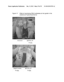 NEUTRALIZING PROLACTIN RECEPTOR ANTIBODIES AND THEIR THERAPEUTIC USE diagram and image