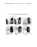 NEUTRALIZING PROLACTIN RECEPTOR ANTIBODIES AND THEIR THERAPEUTIC USE diagram and image