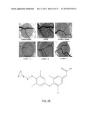 USES OF FORMULATIONS OF THYROID HORMONE ANALOGS AND NANOPARTICULATE FORMS     THEREOF TO INCREASE CHEMOSENSIVITY AND RADIOSENSITIVITY IN TUMOR OR     CANCER CELLS diagram and image