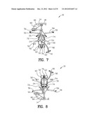 Exercising Apparatus diagram and image