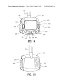 Exercising Apparatus diagram and image