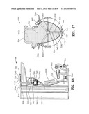 Exercising Apparatus diagram and image