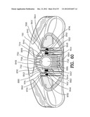 Exercising Apparatus diagram and image