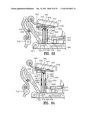 Exercising Apparatus diagram and image