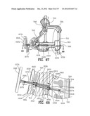 Exercising Apparatus diagram and image