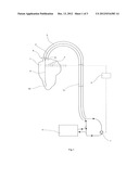 Catheter to Assist the Performance of a Heart diagram and image