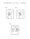 METHOD FOR TREATMENT OF PELVIC ORGAN PROLAPSE CONDITIONS diagram and image